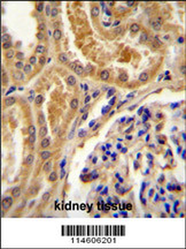 TLL2 Antibody (Center)