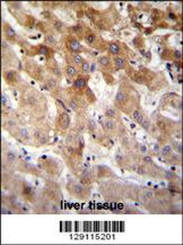 MBTD1 Antibody (C-term)