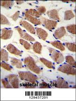 SAMD7 Antibody (Center)