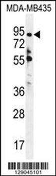 ZNF605 Antibody (N-term)