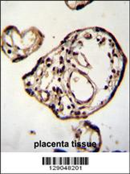 PM20D2 Antibody (C-term)