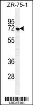 SUSD5 Antibody (C-term)
