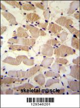 SUSD5 Antibody (C-term)