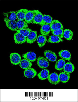 ANKRD34B Antibody (C-term)