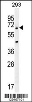 ANKRD34B Antibody (C-term)