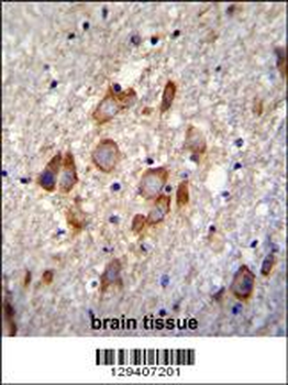 ANKRD34B Antibody (C-term)