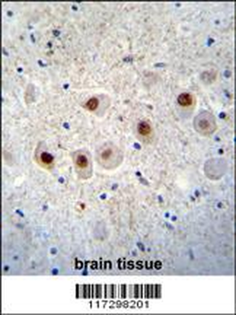RBM14 Antibody (C-term)