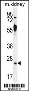 TTC9B Antibody (C-term)