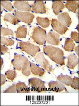 ARL17P1 Antibody (Center)
