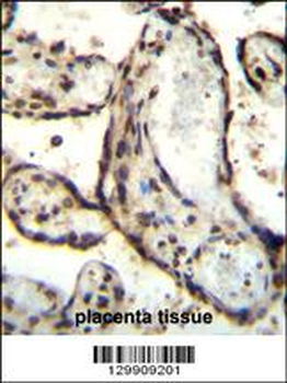 HEXIM1 antibody (Center)