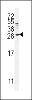 BTC Antibody (N-term)