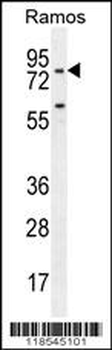 PDE4B Antibody (Center)