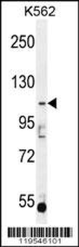 AGBL5 Antibody (N-term)