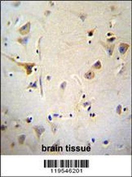 AGBL5 Antibody (N-term)