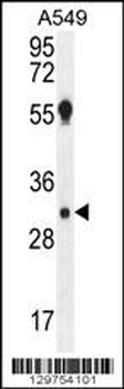 AQP12B Antibody (C-term)