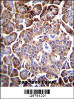 AQP12B Antibody (C-term)