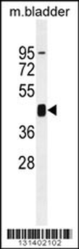 PRKAG1 Antibody (N-term)