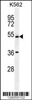 UAP1L1 Antibody (N-term)