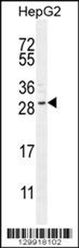 CCDC153 Antibody (N-term)