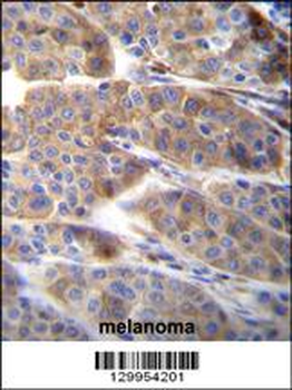 PLA2G2C Antibody (C-term)