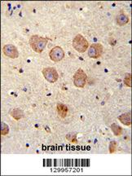 FUSSEL18 Antibody (C-term)