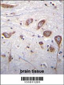 PLCL2 Antibody (C-term)