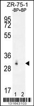 RAB40AL Antibody (N-term)