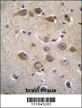 RAB40AL Antibody (N-term)