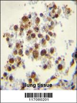 CYP5A1 Antibody (Center)