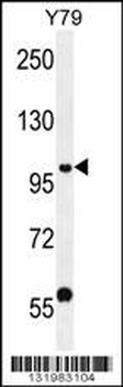 PHF20 Antibody (N-term)