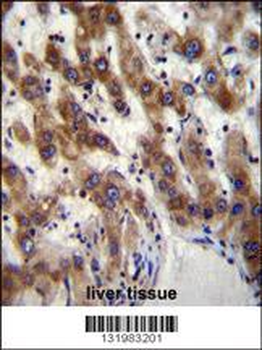 PHF20 Antibody (N-term)