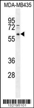 PPP3CC Antibody (N-term)