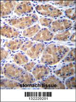 TOR2A Antibody (Center)