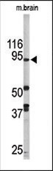 LSD1 Antibody (N-term)