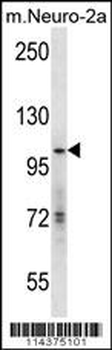 hGCN5 Antibody (C-term)