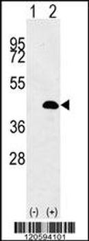 LUC7L Antibody (Center)