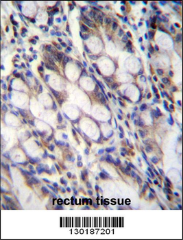 FNDC7 Antibody (C-term)