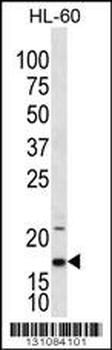 IL1F5 Antibody (N-term)