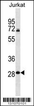 RPL11 Antibody (N-term)