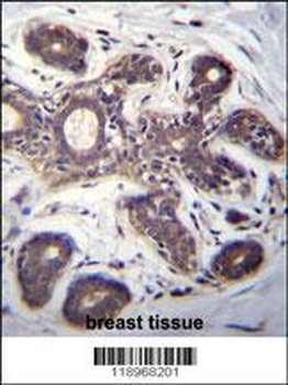 EIF2B1 Antibody (Center)