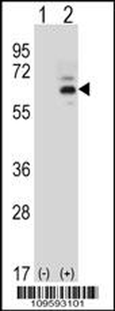 FASTK Antibody (C-term)