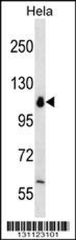 POLR1B Antibody (N-term)