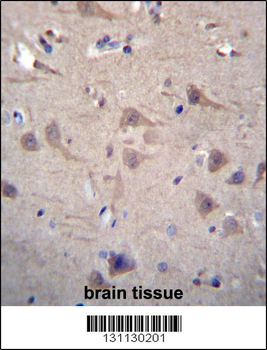 CCT8 Antibody (C-term)