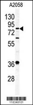 APEH Antibody (N-term)
