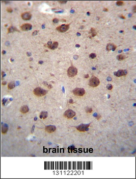 PNKD Antibody (N-term)