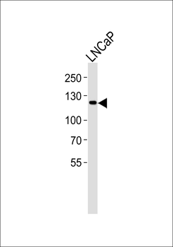 JAK2 Antibody (C-term)