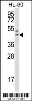 HOXB3 Antibody (Center)