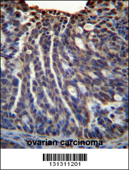 HOXB3 Antibody (Center)