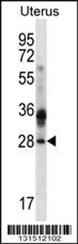 CIB4 Antibody (N-term)