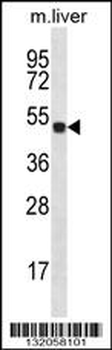 HOXD10 Antibody (C-term)